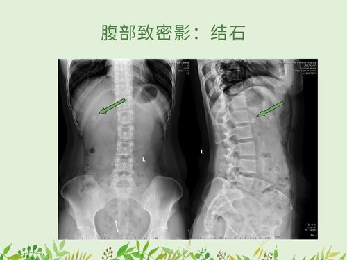 幻灯片20