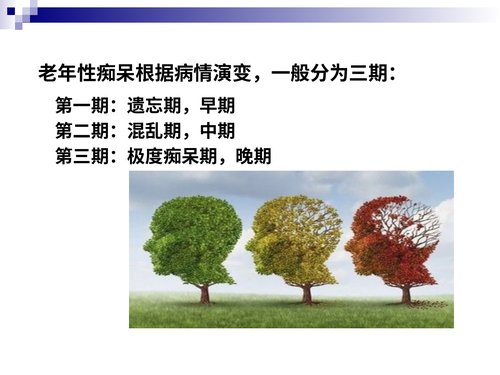 幻灯片4
