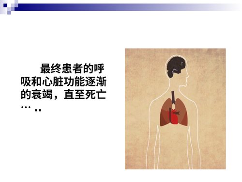 幻灯片10