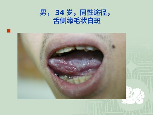 幻灯片11