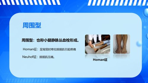 a0061 下肢深静脉血栓的护理查房PPT课件43页可编辑无水印 第6页