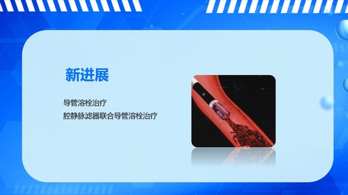 a0061 下肢深静脉血栓的护理查房PPT课件43页可编辑无水印 第9页