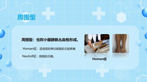 a0062 下肢静脉血栓的护理查房PPT课件43页可编辑无水印 第6页