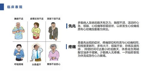 a0085 急性心肌梗死护理查房PPT课件31页可编辑无水印 第9页