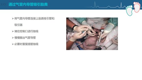 a0092 新生儿复苏CPR护理PPT课件84页可编辑无水印 第11页