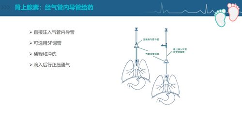 a0092 新生儿复苏CPR护理PPT课件84页可编辑无水印 第13页
