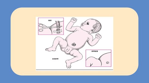 a0094 新生儿脐部护理PPT课件24页可编辑无水印 第7页