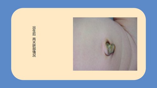 a0094 新生儿脐部护理PPT课件24页可编辑无水印 第11页