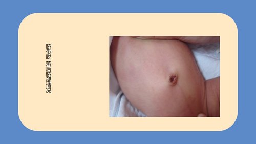 a0094 新生儿脐部护理PPT课件24页可编辑无水印 第13页