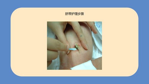 a0094 新生儿脐部护理PPT课件24页可编辑无水印 第14页