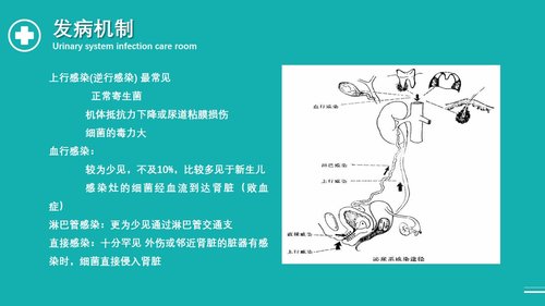 a0096 泌尿外科护理查房PPT课件33页可编辑无水印 第4页