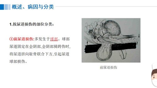 a0117 尿道损伤病人的护理PPT课件21页可编辑无水印 第4页