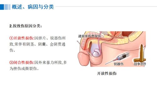 a0117 尿道损伤病人的护理PPT课件21页可编辑无水印 第5页
