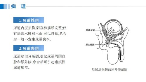 a0117 尿道损伤病人的护理PPT课件21页可编辑无水印 第5页