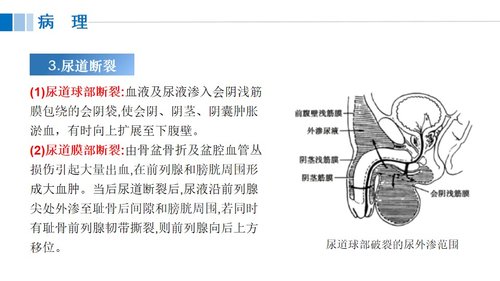 a0117 尿道损伤病人的护理PPT课件21页可编辑无水印 第6页