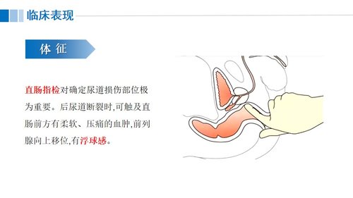 a0117 尿道损伤病人的护理PPT课件21页可编辑无水印 第7页