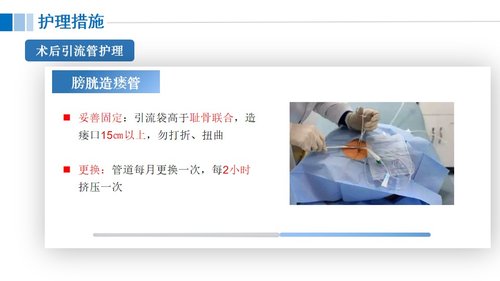 a0117 尿道损伤病人的护理PPT课件21页可编辑无水印 第13页