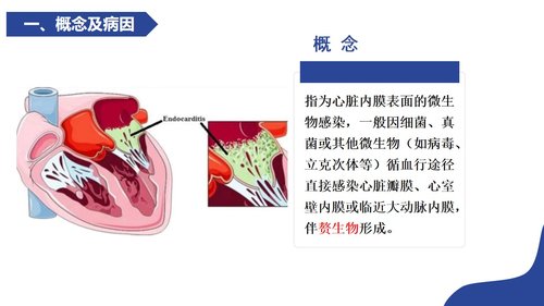 a0119 感染性心内膜炎病人的护理PPT课件21页可编辑无水印 第3页
