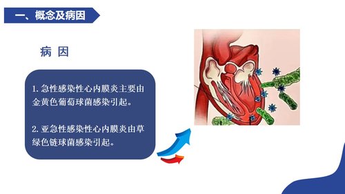 a0119 感染性心内膜炎病人的护理PPT课件21页可编辑无水印 第4页
