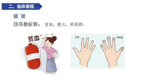 a0119 感染性心内膜炎病人的护理PPT课件21页可编辑无水印 第7页