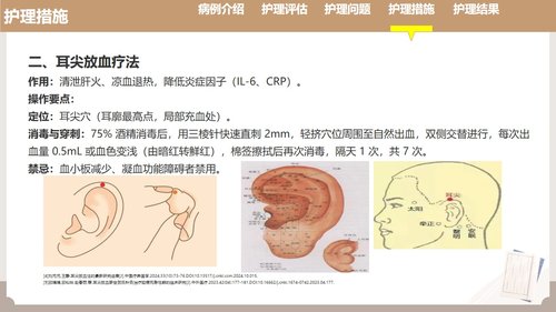 a0121 耳部全息铜砭刮痧联合耳尖放血在脑梗死介入取栓术后发热患者中的护理实践（33页）PPT课件33页可编辑无水印 第9页
