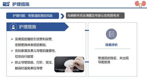 a0122 肾母细胞瘤破裂出血PPT课件29页可编辑无水印 第15页