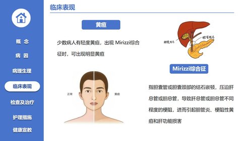 a0123 胆囊结石病人的护理PPT课件21页可编辑无水印 第6页