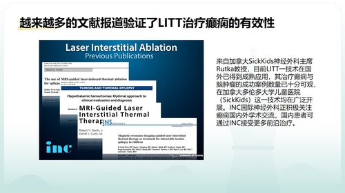 a0125 脑损伤激光间质热疗法PPT课件20页可编辑无水印 第14页