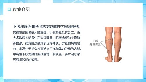 a0127 下肢静脉曲张护理查房PPT课件30页可编辑无水印 第3页