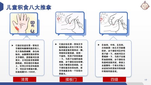 a0129 儿童积食推拿护理PPT课件20页可编辑无水印 第13页