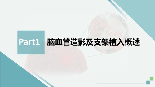 a0135 脑血管造影及支架植入术后护理PPT课件32页可编辑无水印 第2页