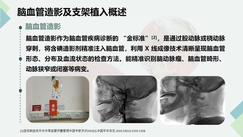 a0135 脑血管造影及支架植入术后护理PPT课件32页可编辑无水印 第3页