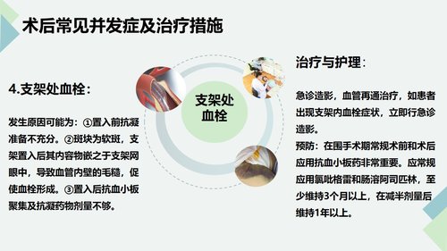 a0135 脑血管造影及支架植入术后护理PPT课件32页可编辑无水印 第13页