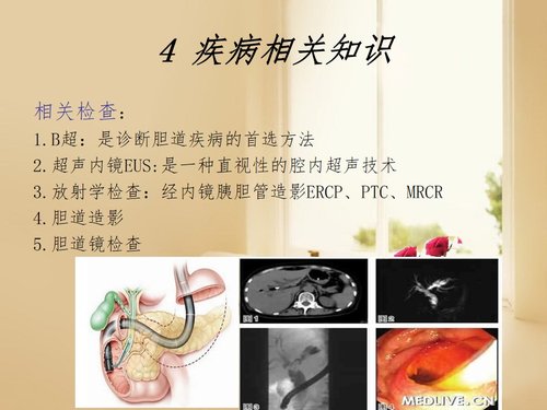 a0148 一例胆总管结石患者的围手术期的护理PPT课件41页可编辑无水印直接可用 第15页