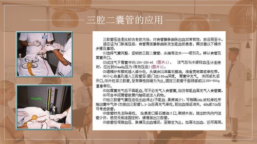 a0150 上消化道出血护理查房PPT课件34页可编辑无水印直接可用 第13页