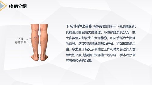 a0151 下肢静脉曲张的护理查房PPT课件30页可编辑无水印直接可用 第4页