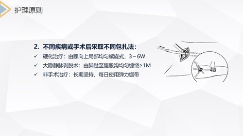 a0151 下肢静脉曲张的护理查房PPT课件30页可编辑无水印直接可用 第19页