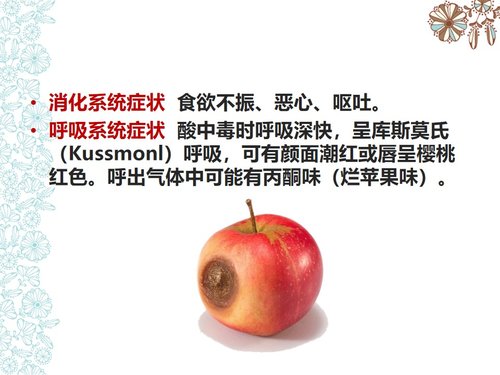 a0154 儿童糖尿病酮症酸中毒护理查房PPT课件73页可编辑无水印直接可用 第4页