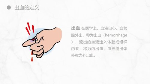 a0155 出血的观察和护理知识PPT课件21页可编辑无水印直接可用 第4页