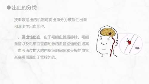 a0155 出血的观察和护理知识PPT课件21页可编辑无水印直接可用 第5页