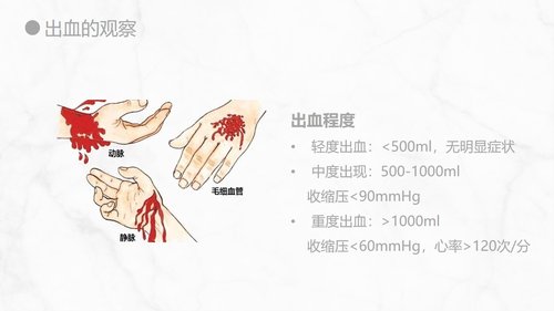 a0155 出血的观察和护理知识PPT课件21页可编辑无水印直接可用 第9页