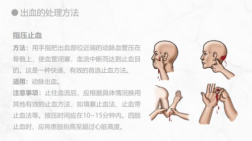 a0155 出血的观察和护理知识PPT课件21页可编辑无水印直接可用 第12页