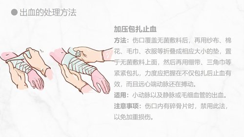 a0155 出血的观察和护理知识PPT课件21页可编辑无水印直接可用 第13页