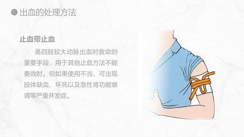 a0155 出血的观察和护理知识PPT课件21页可编辑无水印直接可用 第14页
