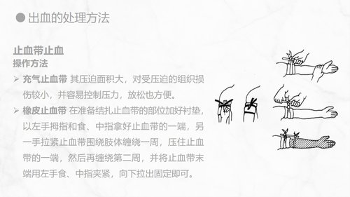 a0155 出血的观察和护理知识PPT课件21页可编辑无水印直接可用 第15页