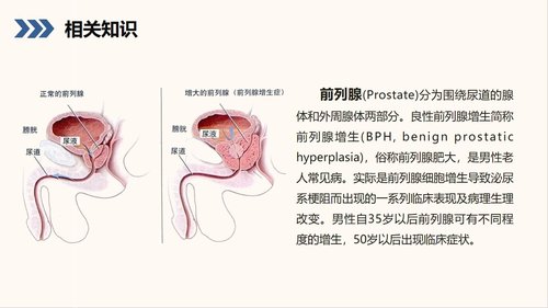 a0156 前列腺增生护理查房知识课件PPT课件28页可编辑无水印直接可用 第3页