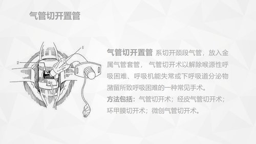 a0159 危重病人的病情观察及护理措施PPT课件91页可编辑无水印直接可用 第9页