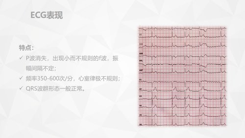 a0159 危重病人的病情观察及护理措施PPT课件91页可编辑无水印直接可用 第15页
