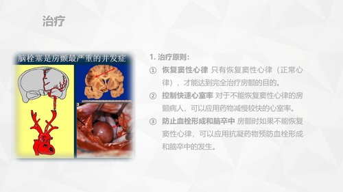 a0159 危重病人的病情观察及护理措施PPT课件91页可编辑无水印直接可用 第16页