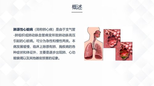 a0162 呼吸系统常见疾病的护理业务课件PPT课件32页可编辑无水印直接可用 第14页